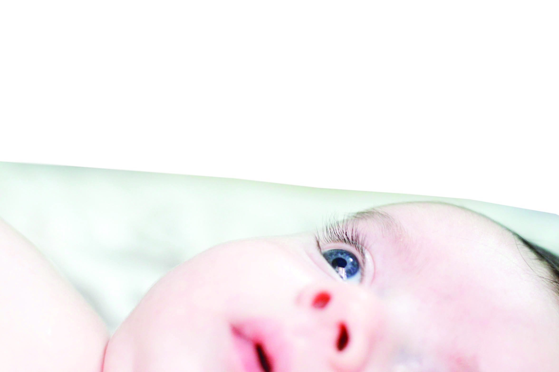 ¿Fondo de ojo en el recién nacido? - Opción Médica